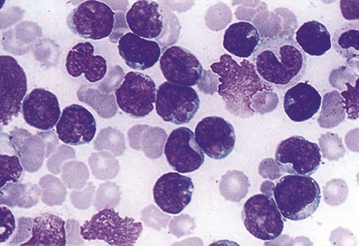 Клеточный иммунитет &ndash; создатель теории, неспецифические клетки