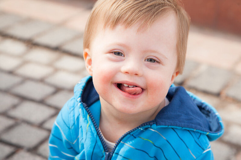 Мутационная изменчивость — виды, классификация и примеры