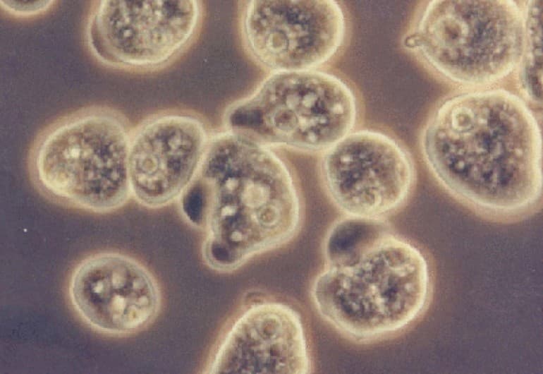 Саркодовые &mdash; общая характеристика класса, строение, жизненный цикл