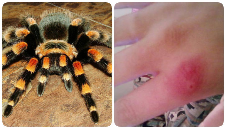 Антидот от укуса: найдено 85 изображений