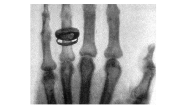 Открытие рентгеновских лучей &ndash; краткий доклад об истории и&nbsp;значении